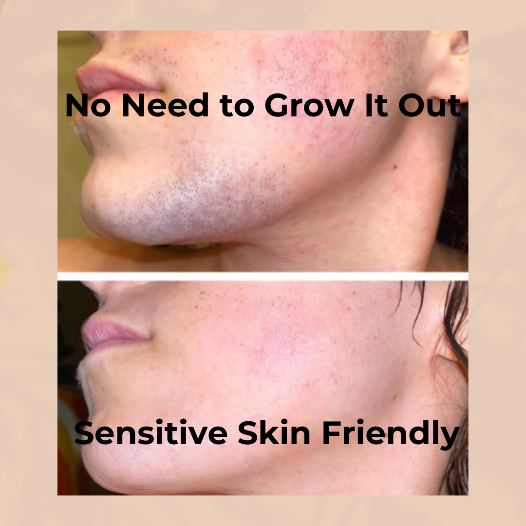 🔥Mother's Day Sale 50% OFF🎁 Hair Removal Kit